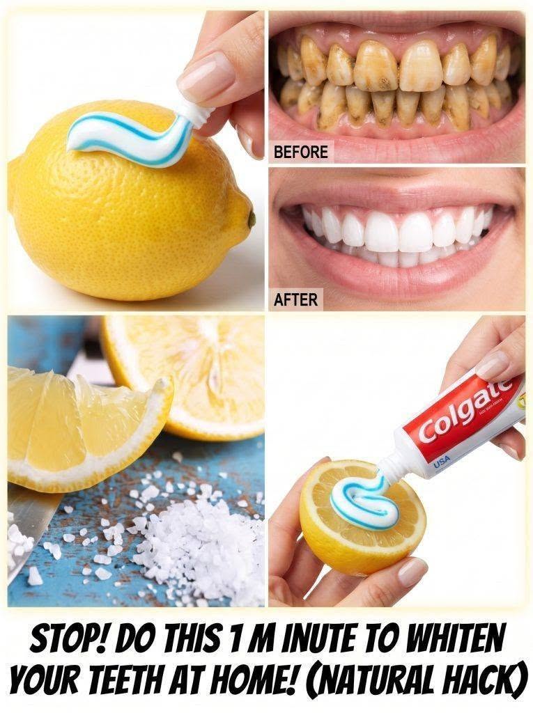 A lemon trick promises whiter teeth, but experts warn this kitchen remedy must be used with caution