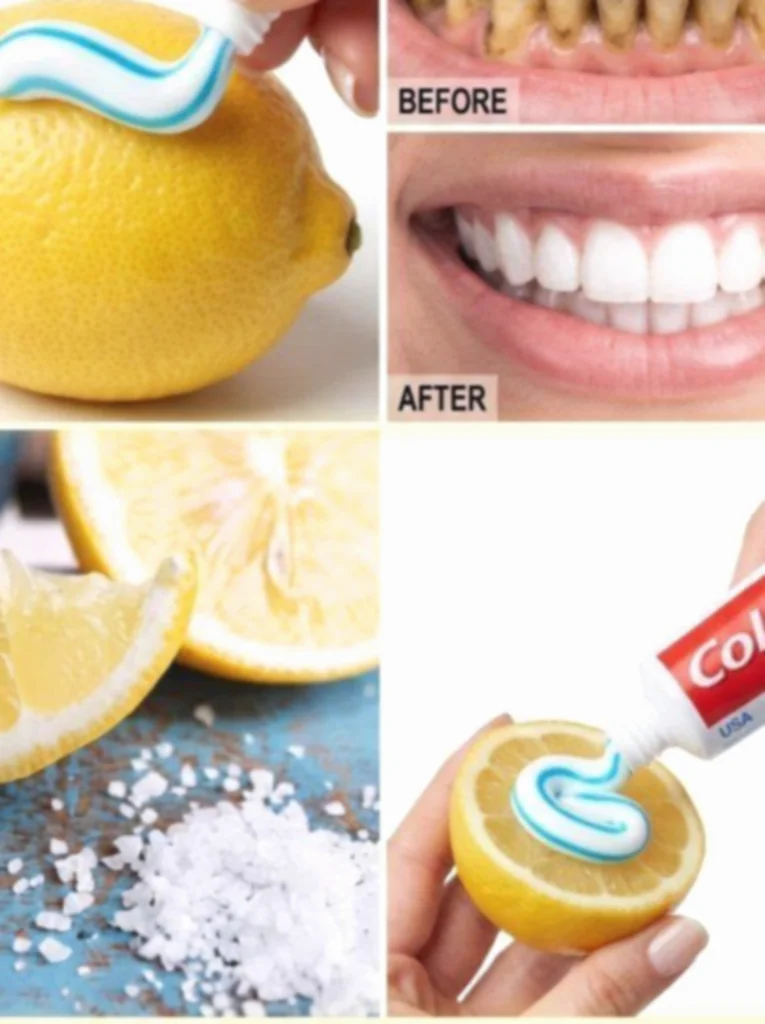 A lemon trick promises whiter teeth, but experts warn this kitchen remedy must be used with caution