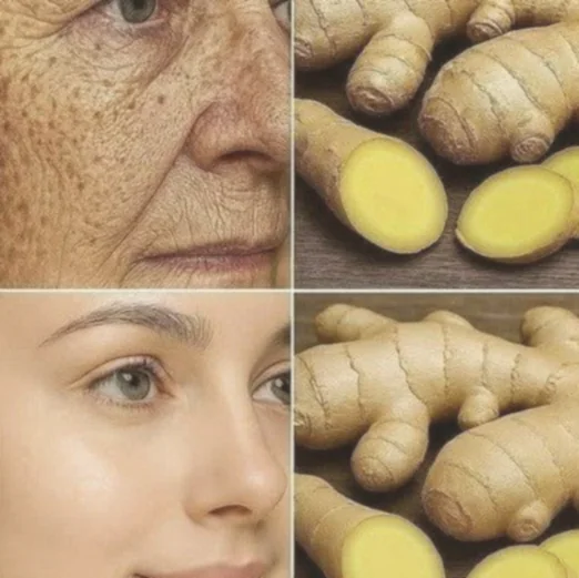 Ginger is 100 times more effective than Botox at eliminating deep wrinkles, freckles, and discoloration. I have to say something so you keep receiving my recipes… Thank you! 😍 Recipe in (comment)