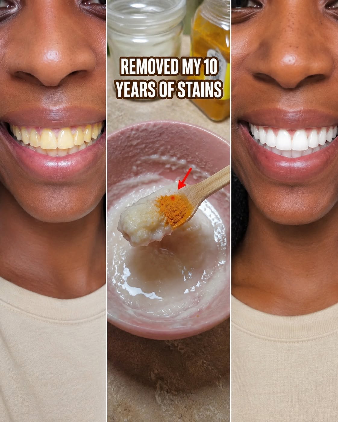 in two minutes remove 10 years of stains from teeth!! Results will Shock You