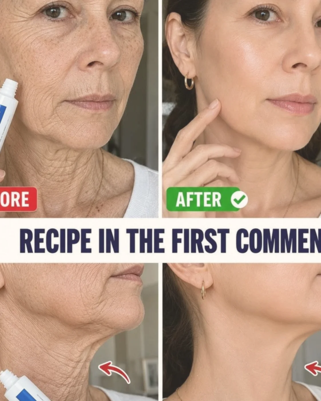 “It looks like I had plastic surgery”: The home remedy used to improve the appearance of wrinkles and dark spots on hands and arms. To keep getting my recipes, you just have to say… Thank you!