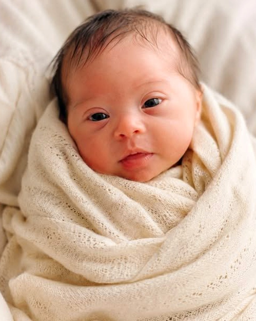 A Mother’s Heartbreak and Unexpected Connection: A Powerful Story of Down Syndrome and Love