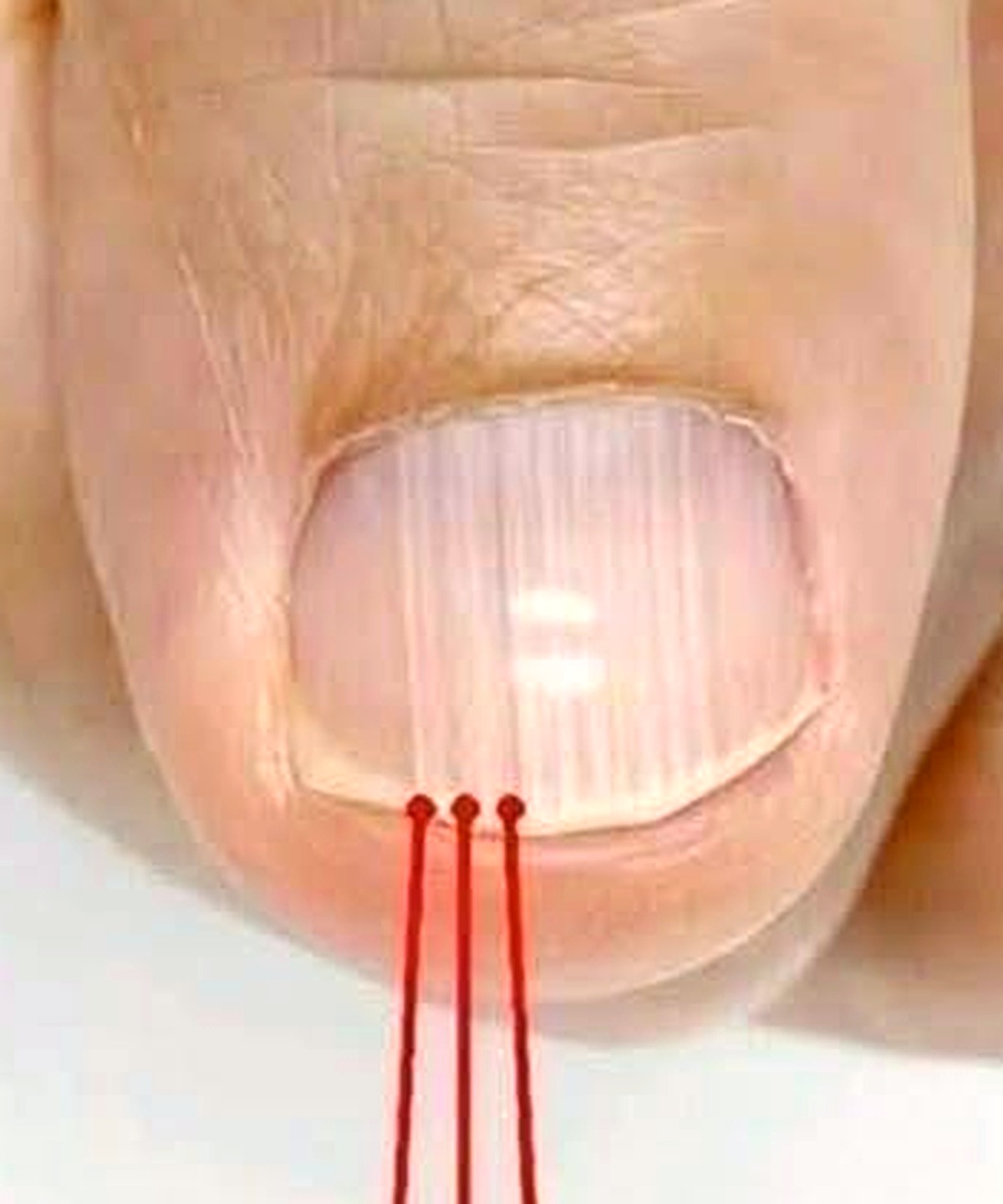 Vertical Ridges on Your Fingernails and Prominent Hand Veins After 40: What They Really Mean